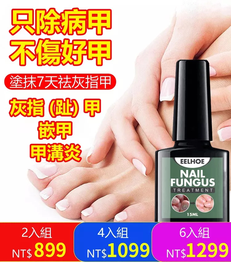 限時搶購 得了灰指甲,一個傳染兩,早發現早治療!別在花冤枉錢,一用它3天就見效!然草本抗菌配方,深入滲透,只去壞甲不傷好甲,永久治療灰指甲 限時搶購 得了灰指甲,一個傳染兩,早發現早治療!別在花冤枉錢,一用它3天就見效!然草本抗菌配方,深入滲透,只去壞甲不傷好甲,永久治療灰指甲